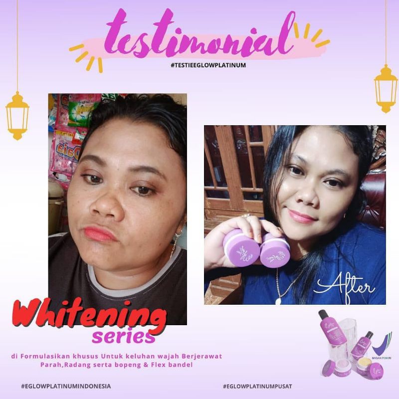 ORIGINAL EGLOW PLATINUM SKINCARE PAKET GLOWING ACNE WHITENING ORIGINAL ASLI / BPOM SKINCARE MURAH HEMAT MEWAH / FREE GIFT HADIAH / SKINCARE TERLARIS AMAN BPOM HALAL PALING AMPUH UNTUK SEGALA KULIT WAJAH-3