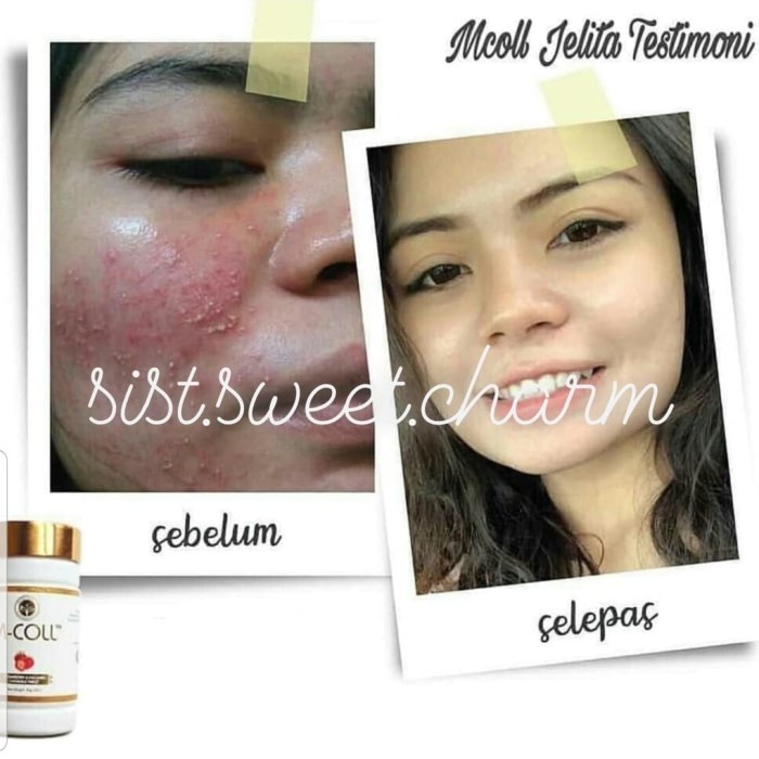 {cantikstore} M-COLL Kolagen Permen Collagen Candy Limited