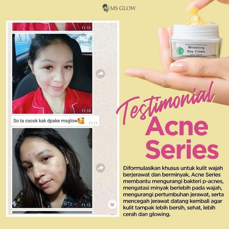 Ms Glow Paket Acne Free Pouch