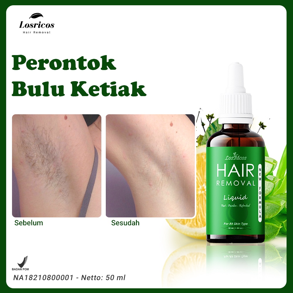 Jual Losricos Hair Removal Liquid Obat Perontok Bulu Permanen BPOM isi 50ml, Penghilang Bulu