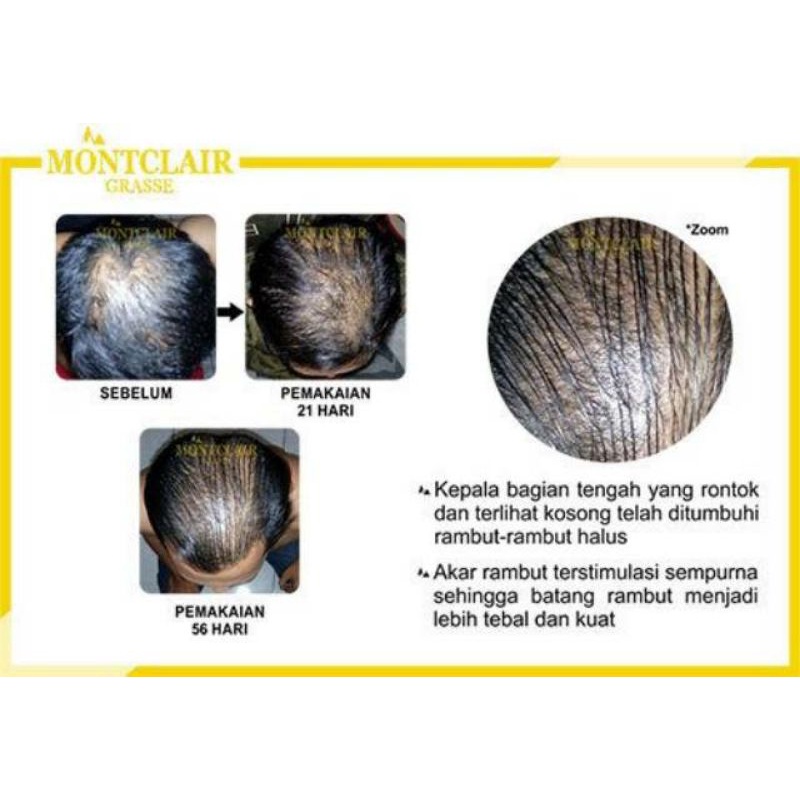 Montclair Hair Serum dari Montclair Grasse Serum Obat Penumbuh Rambut Anti Botal 100% ORIGINAL BEST SELLER