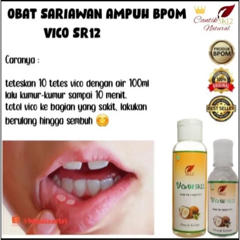 Obat Sariawan Ampuh VCO OIL SR12 Mengobati Sariawan Anak dan Dewasa