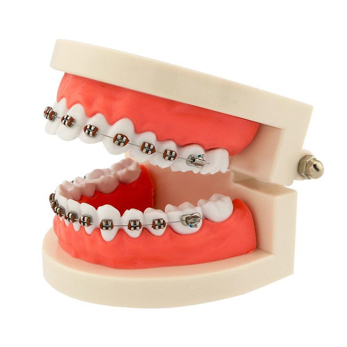 Dental model ortho study model orthodontic phantom studi behel braces bracket kawat gigi metal