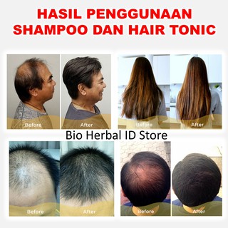 Image of thu nhỏ Shampoo Anti Rontok Obat Ketombe Dan Rambut Rontok Hair Loss Shampoo B1B #4