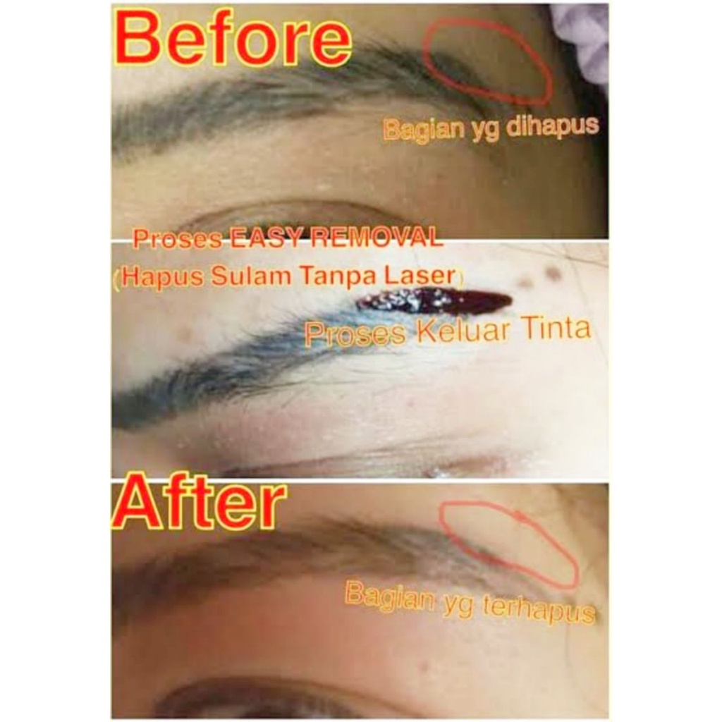 Ulzzang Removal Solution Eraser Penghapus Tinta Sulam Tatto