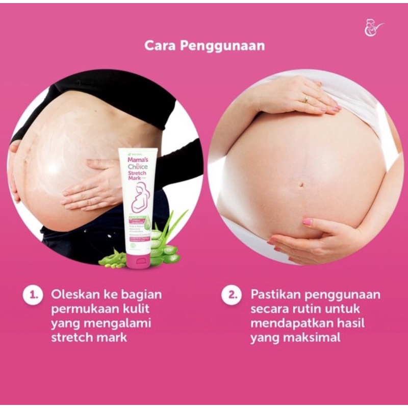 Mama's Choice Stretch Mark Cream 100ml | Mamas Choice Krim Selulit