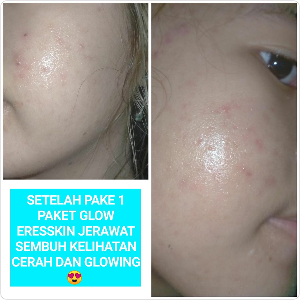 [ORIGINAL] GLOW TONER WAJAH / MUKA / FACE PEMUTIH WHITENING GLOWING ORI BPOM MULUS PEMBERSIH ARTIS