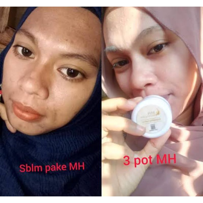 MH WHITENING SKIN
