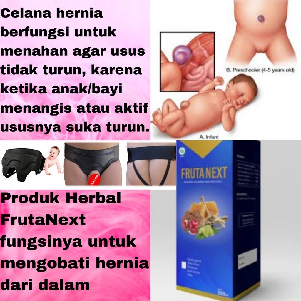 FrutaNext Obat Herbal Hernia Bayi - Balita - Anak Paling Ampuh
