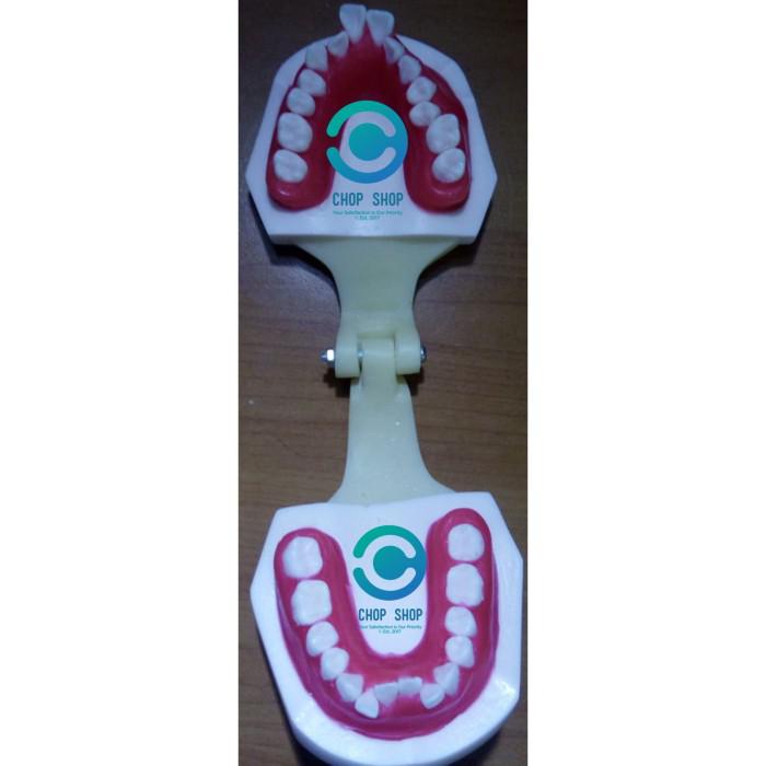 Dyla/ Model Phantom Typodont Ortho Bahan Wax Latihan Ortho Kawat Gigi