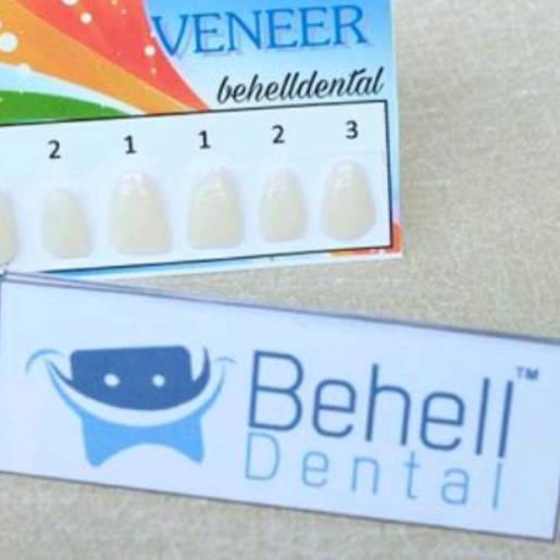 Teeth Veneer, Gigi Aplikasi, Gigi Kelinci. Vener