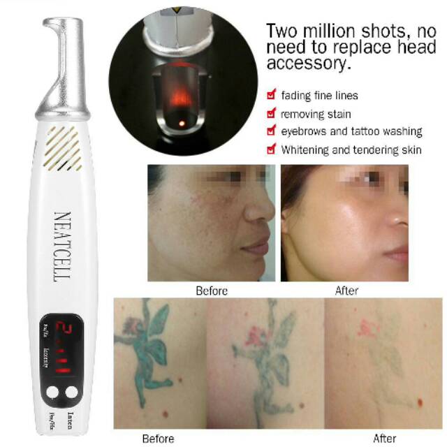 Laser Merah Neatcell Penghilang Tatto