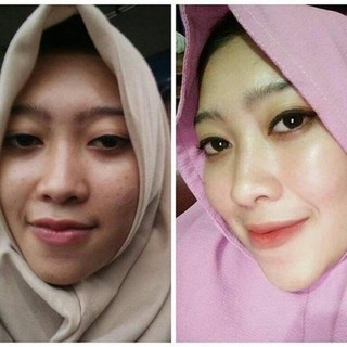 Apakah Produk Ms Glow Aman Untuk Ibu Hamil  Menyusui