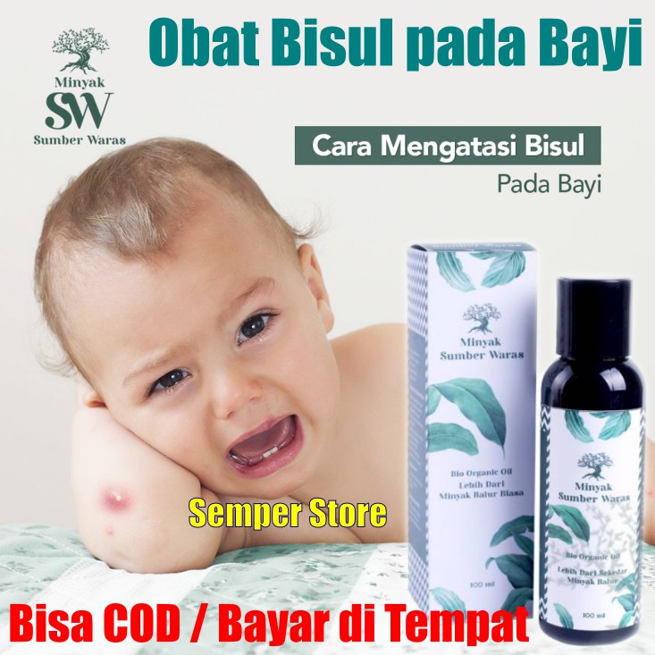 Obat Bisul Pada Bayi Ampuh Aman Tanpa Efeksamping Minyak Sw Balur Probiotik Sumber Waras Bpom Asli Shopee Indonesia