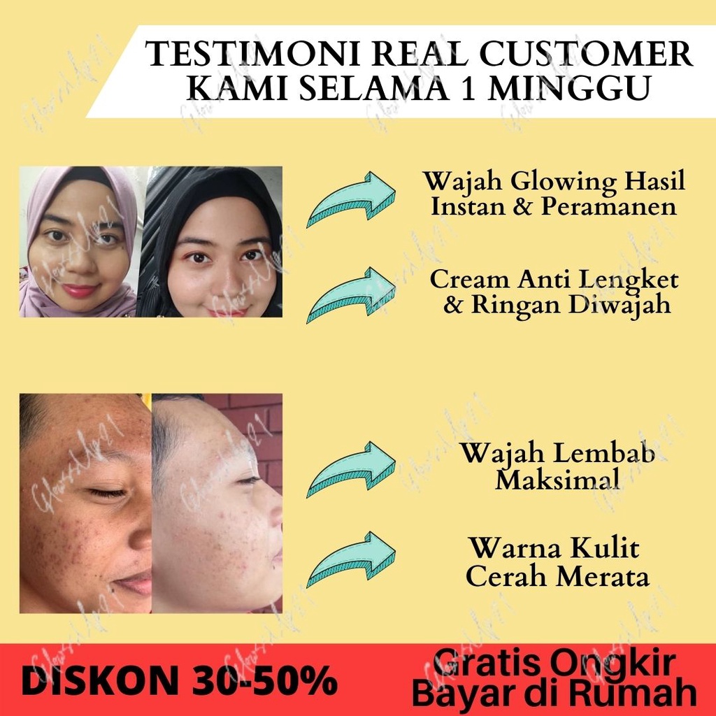 Pelembab Wajah Avoskin YSB Glow Concentrate 2% Alpha Arbutin+Microbiome+Beta Carotene Treatment Wajah