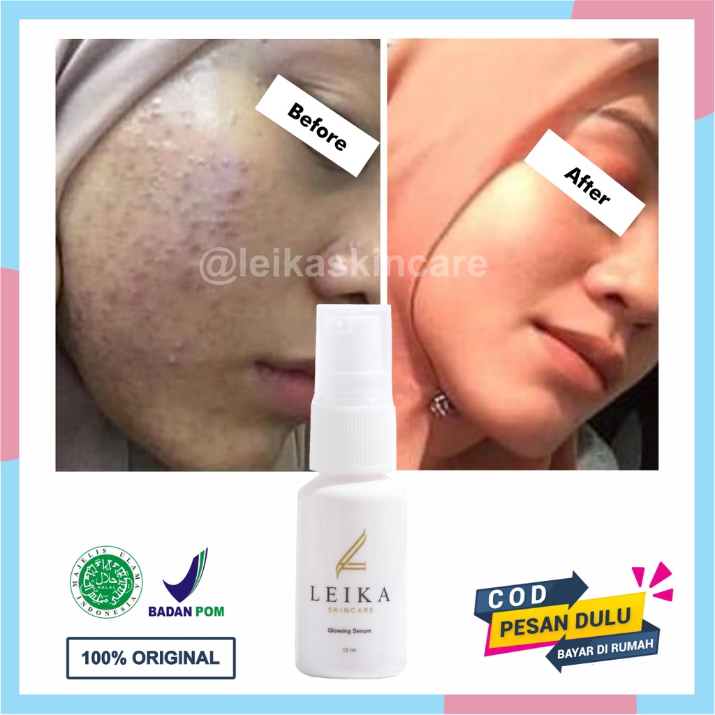 Original Serum Penghilang Bruntusan Serum Untuk Bruntusan Ampuh Permanen Serum Wajah Bruntusan Wanit