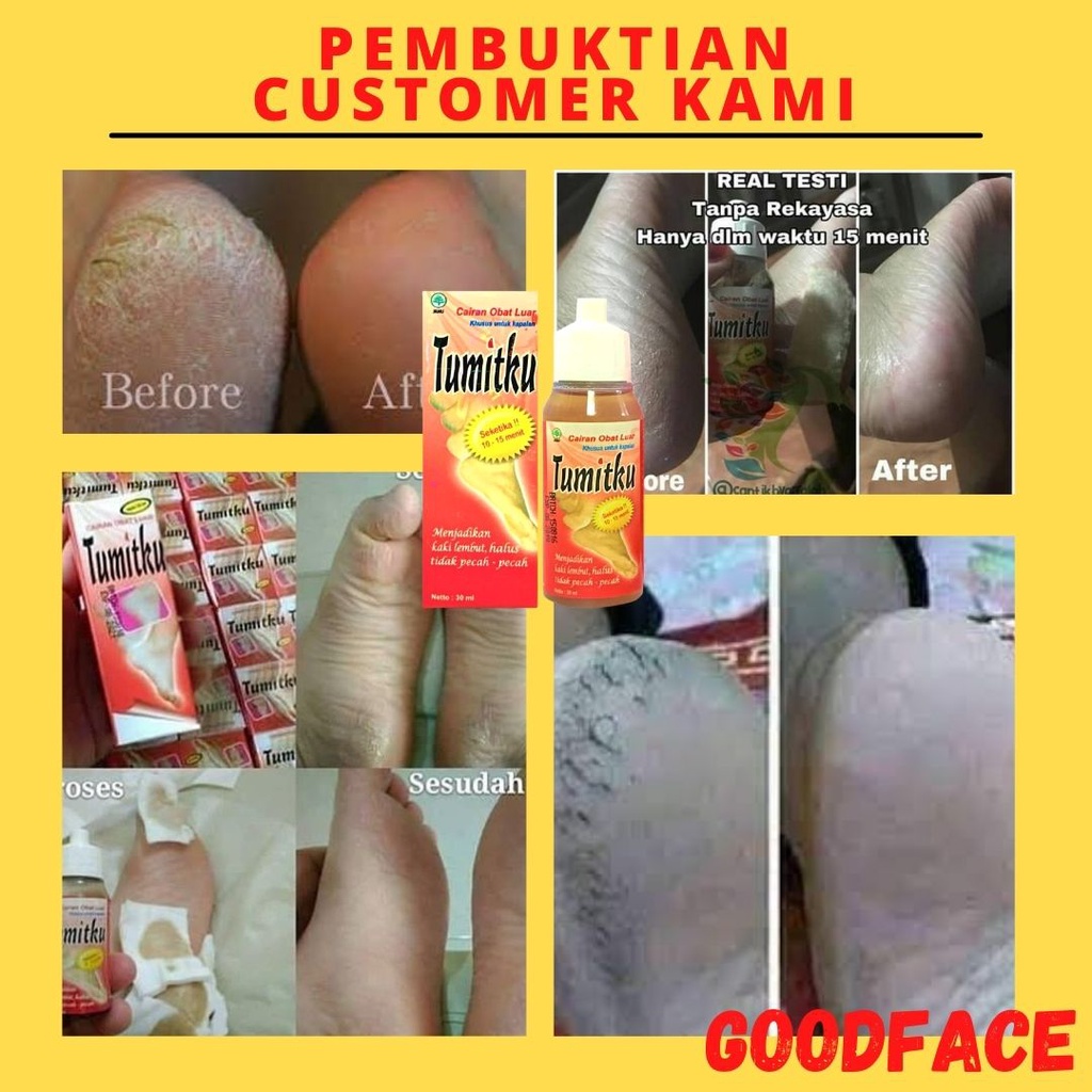 TUMITKU 60ML ORIGINAL PENGHALUS TUMIT AMPUH