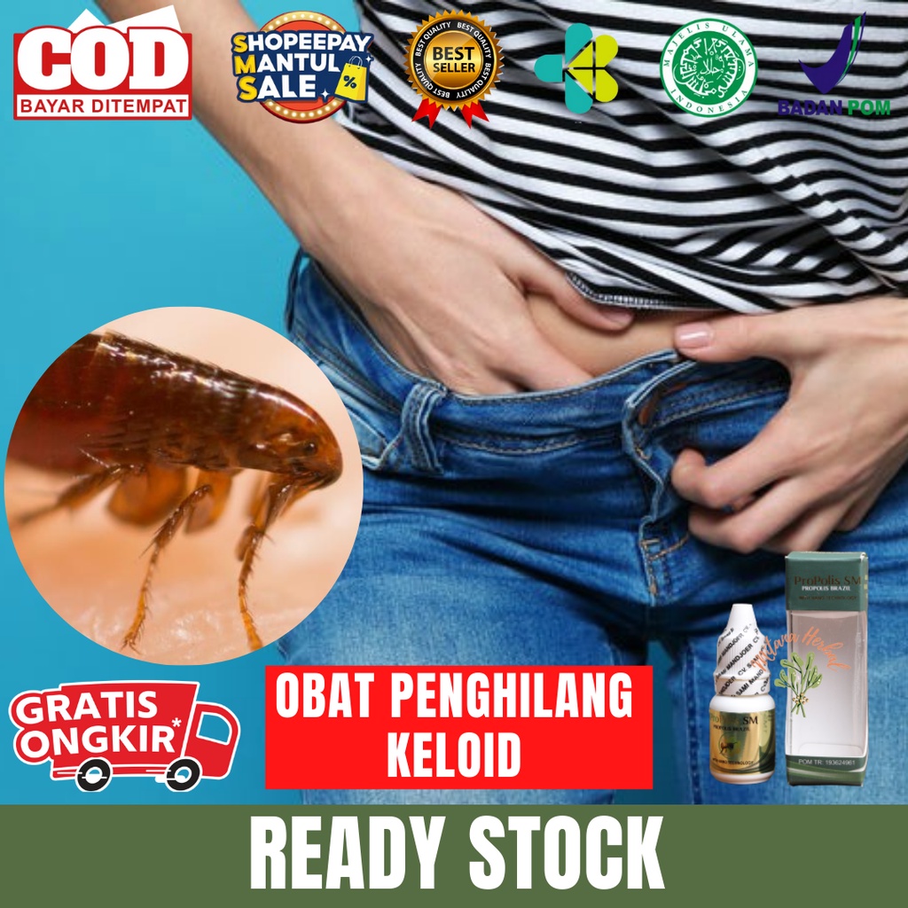 Obat Tetes Kutu Kemaluan, Obat Penghilang Kutu Kemaluan, Gatal Di Kemaluan, Pembasmi Kutu Kemaluan, 