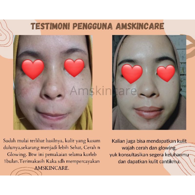 PAKET KULIT NORMAL BY AMSKINCARE | PUTIH GLOWING