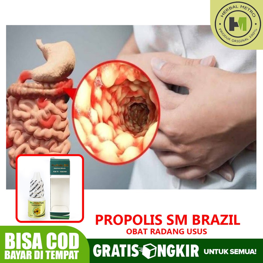 Obat Radang Usus Radang Usus Besar Radang Usus Anak Dan Dewasa Herbal Propolis Jakarta Timur Cod Shopee Indonesia