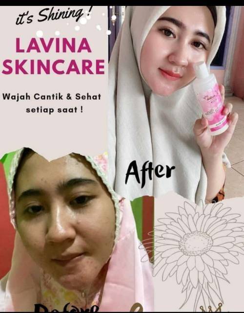 cream lavina skincare bpom