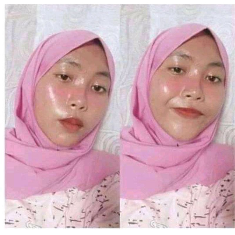 Paket Hemat Glowing Terlariss Ampuh 5 Hari Hilangkan Flek