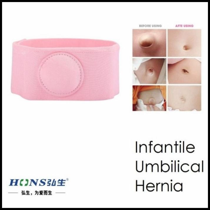 Hons Sabuk Hernia Bayi, Sabuk Hernia, Sabuk Pusar Bodong, Sabuk Hernia