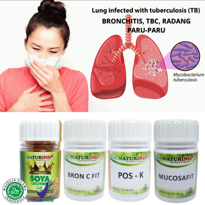 

Naturindo Herbal Bronkitis Herbal TBC Herbal Radang Paru-Paru Ampuh Manjur Obat Herbal Alami