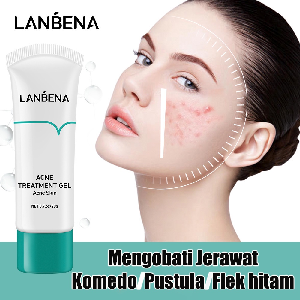 【Barang spot】Treatment Jerawat Perawatan Jerawat Ampuh Jerawat Gel Krim Jerawat Bruntusan Kulit Sensitif/Flek Hitam /Krim Jerawat Pria Wanita Cream Jerawat Ampuh Punggung /Wajah Pelembab Pemutih Perawatan Kulit Acne Gel Acne Serum Treatment Gel Moisturizi