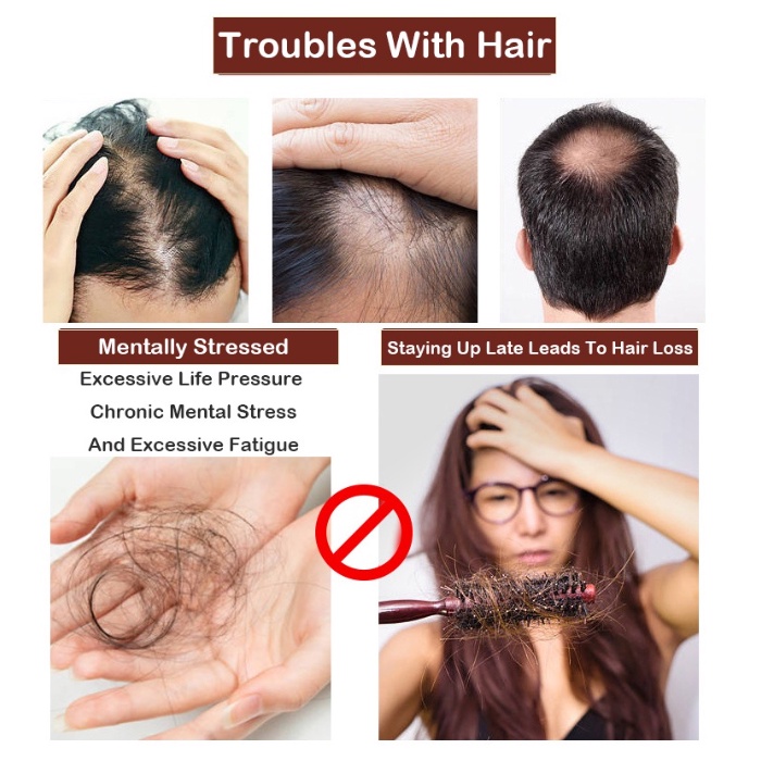 【ORIGINAL】Sampo jahe Shampo penumbuh rambut Shampo anti rambut rontok 300ML Ketombe Merangsang pertumbuhan rambut Mencegah kebotakan Garis rambut Rambut rontok Bahan herbal jahe