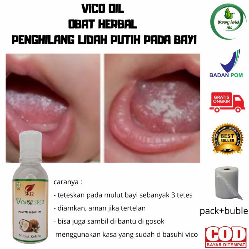 OBAT SARIAWAN BAYI/OBAT LIDAG PUTIH PADA BAYI/OBAT JAMUR MULUT BAYI AMAN HALAL BPOM AMAN JIKA TERTEL