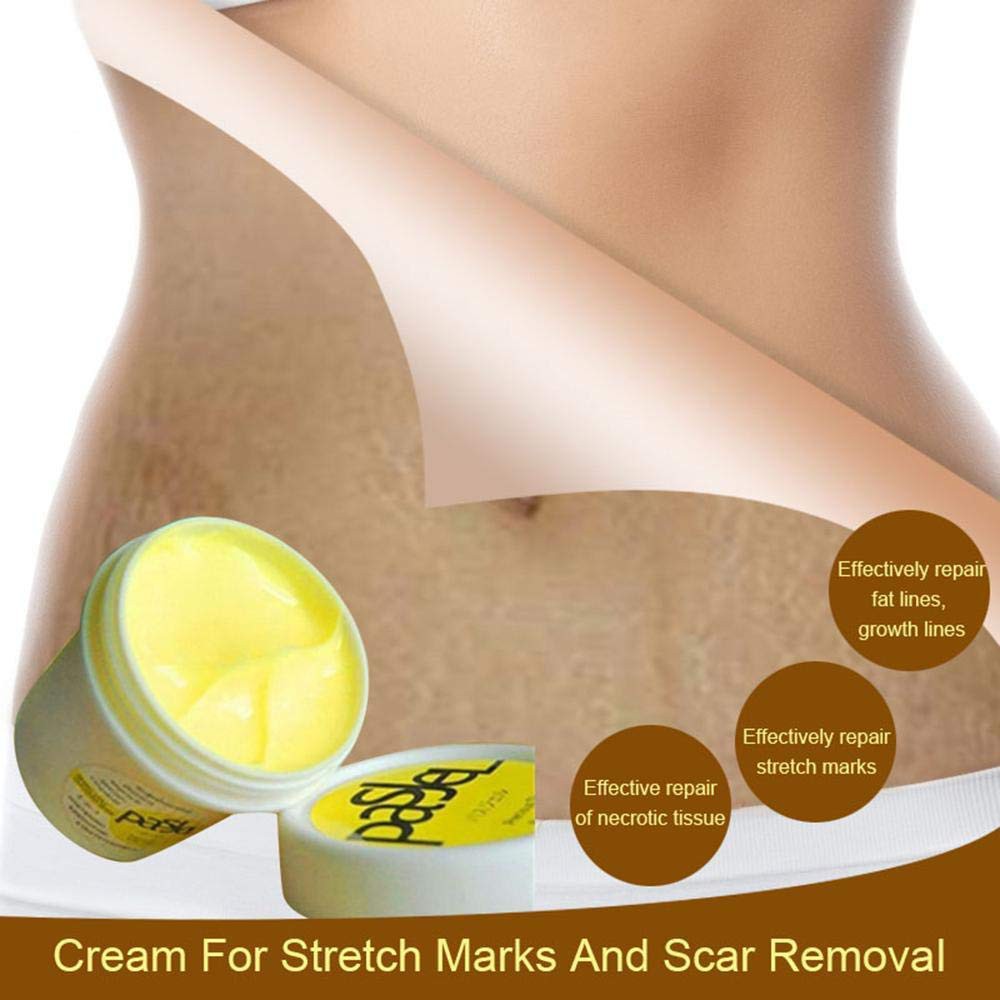 PASJEL CREAM ANTI STRETCH MARK / OBESITAS UBTUK PERWATAN TUBUH