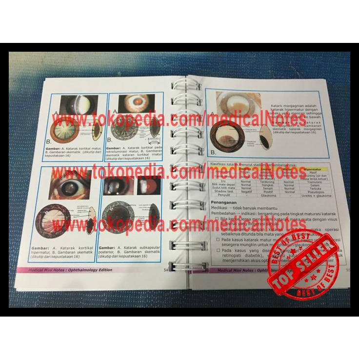 

TERBARUU!! Buku Saku Kedokteran Medical Mini Notes Ophthalmology (MATA) TERBARU
