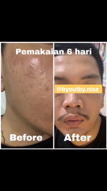 NECK CREAM WAJAH KRIM LEHER HITAM PEMUTIH KOREA HALAL ORI BPOM FARMA AMPUH DOKTER FARMASI SKINCARE GLOWING SKINCARE ORIGINAL TERBAIK DI SHOPEE UNTUK CEWEK COWOK BUMIL BUSUI AMAN ORI SENSITIVE SKIN KULIT SENSITIF AMAN MENCERAHKAN LEHER HITAM KOREAN KOREA