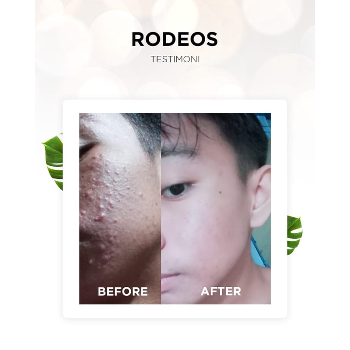 Paket Lengkap Rodeos Skincare Pria Sabun Cream Perawatan Pencerah Pemutih Wajah Pria Rodeos BPOM SM5