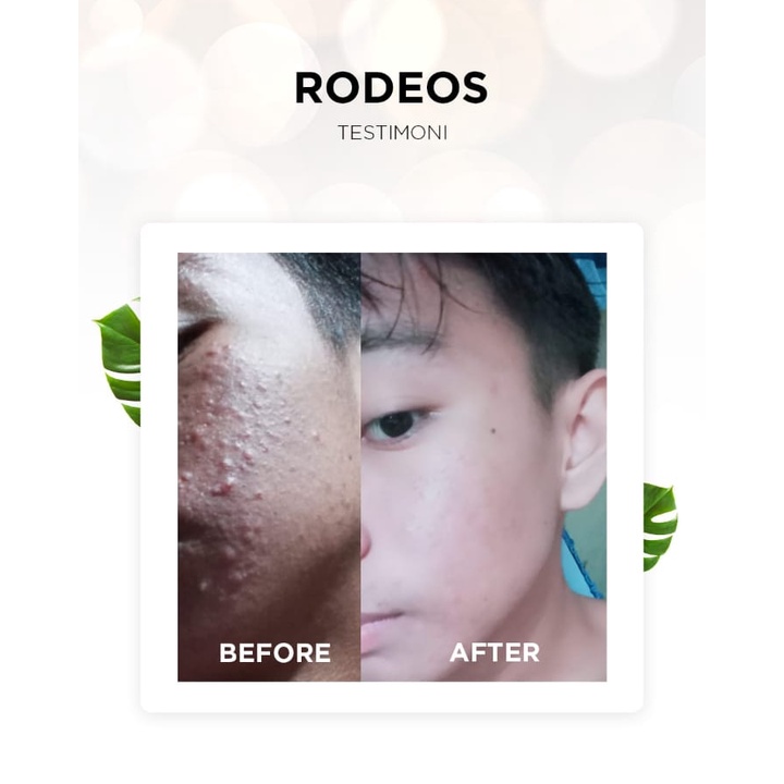 Rodeos Skincare Pria Perawatan Wajah Pria Mencerahkan Wajah Berjerawat Kusam Flek Hitam SM0