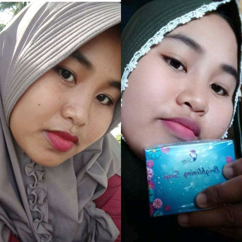 Sabun Pemutih Wajah l Gold Jelly l Body Serum Kedas Beauty 100% Original Free Gift
