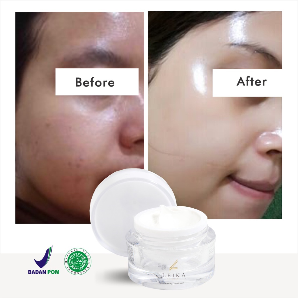 Glowing Putih Cepat! Krim untuk Kulit Wajah Glowing Putih Cepat Original BPOM Halal Murah Ampuh Cream Wajah Glowing Korea Asli Permanen Glowing Day Cream Leika Skincare 10gr Resmi BPOM