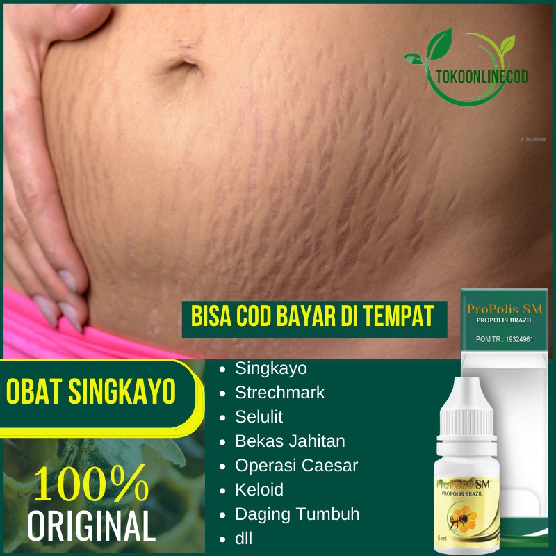 Jual Obat Singkayo Strechmark Selulit Bekas Jahitan Operasi Caesar di