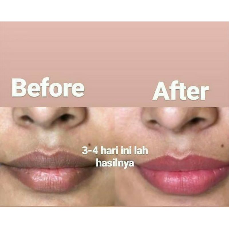 

Lipsmaks