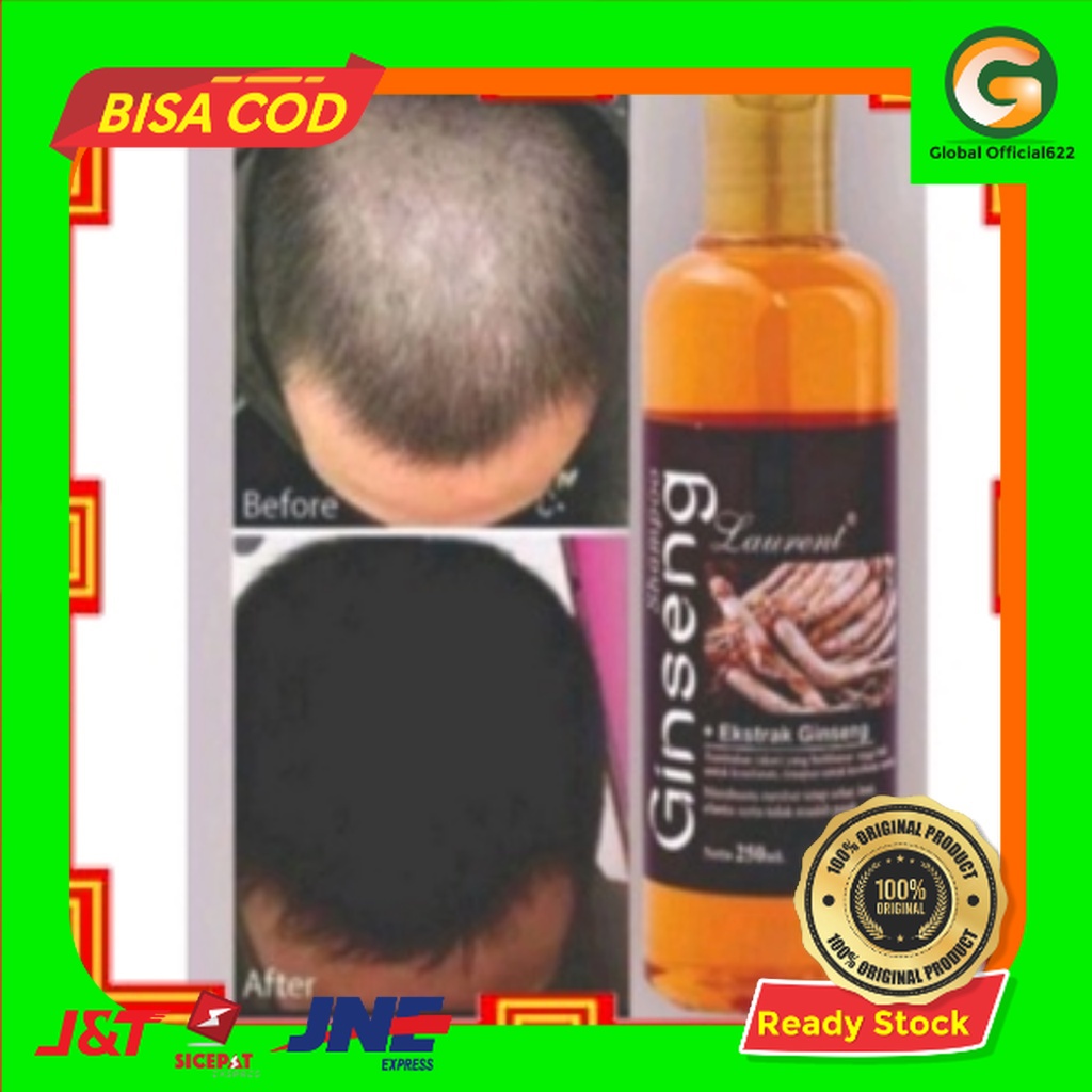 Shampoo Penumbuh Rambut Botak Shampoo Ginseng Penumbuh Rambut Obat Botak Vitamin Rambut Penumbuh