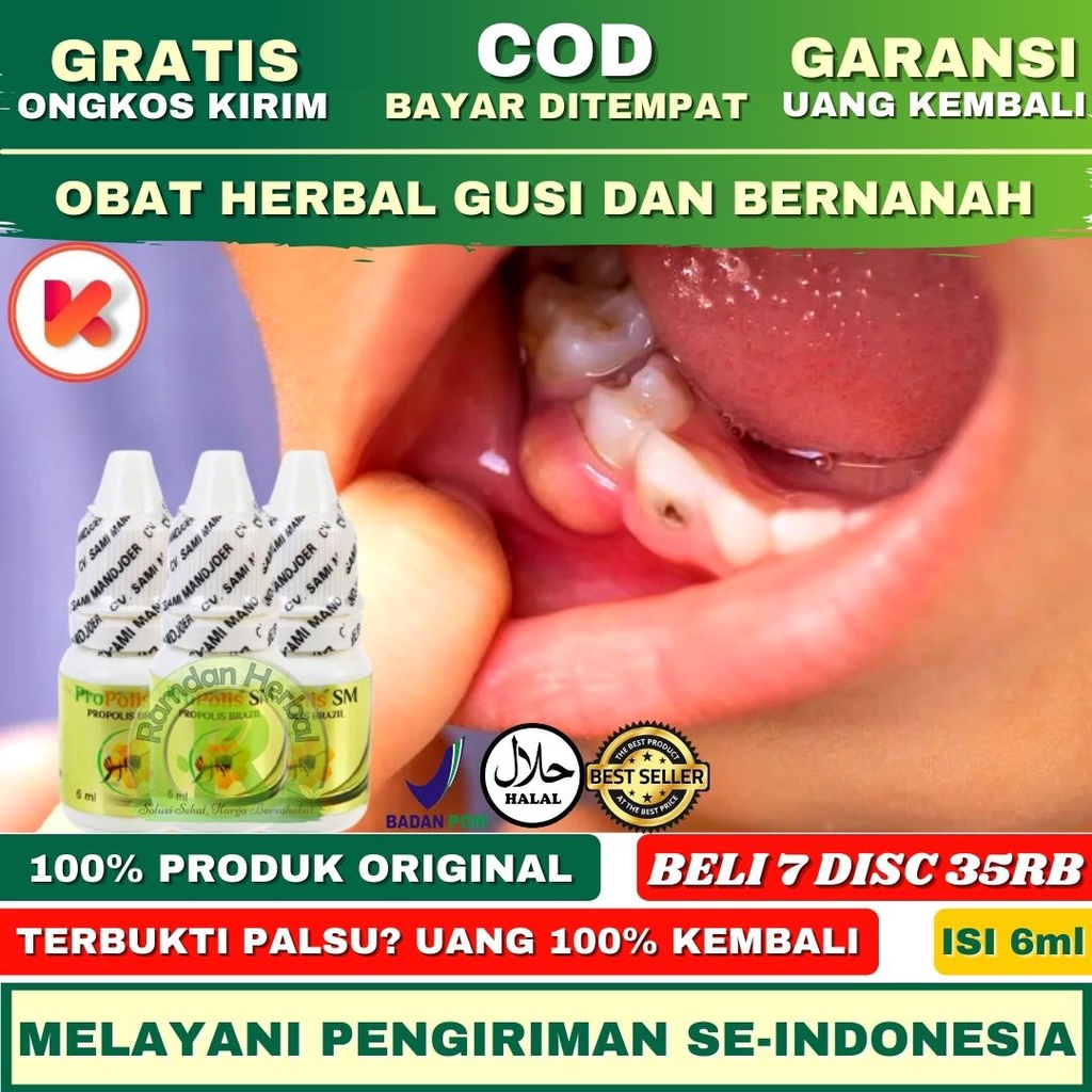 Obat Gusi Bengkak dan Bernanah Gusi Bernanah Benjolan Di Gusi Bernanah Bau Mulut Sakit Rahang Mulut 