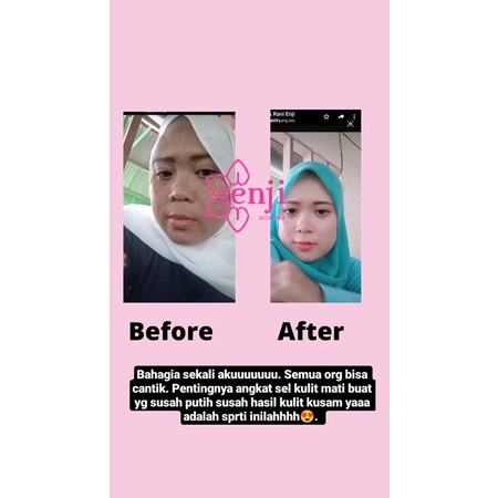 TERAMPUH!! Skincare Bpom Cream Pemutih Wajah 