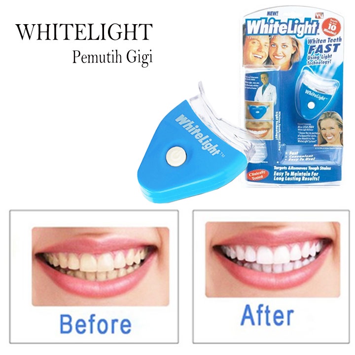 Hope Store - Whitelight Alat Pemutih Gigi Perawatan Pembersih Gigi Kuning Whitening Teeth / Alat Pemutih Gigi Instan