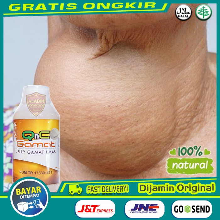 

[ COD ] - Obat Tiroid Bengkak - Pembengkakan tiroid, Nodul Tiroid, Hipertiroid, Gondok - Qnc Gamat