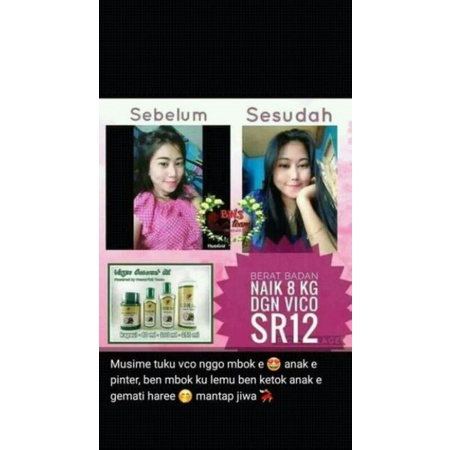 VICO KAPSUL SR12/ Penambah berat badan/ Penambah nafsu makan/ obat gemuk badan/

