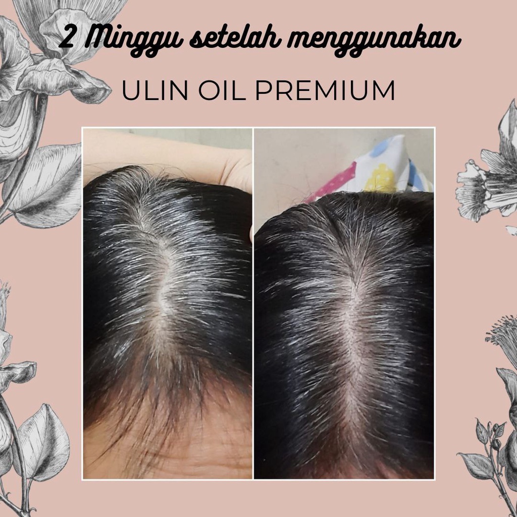 Penghitam Rambut Uban Ulin Hair Oil Premium