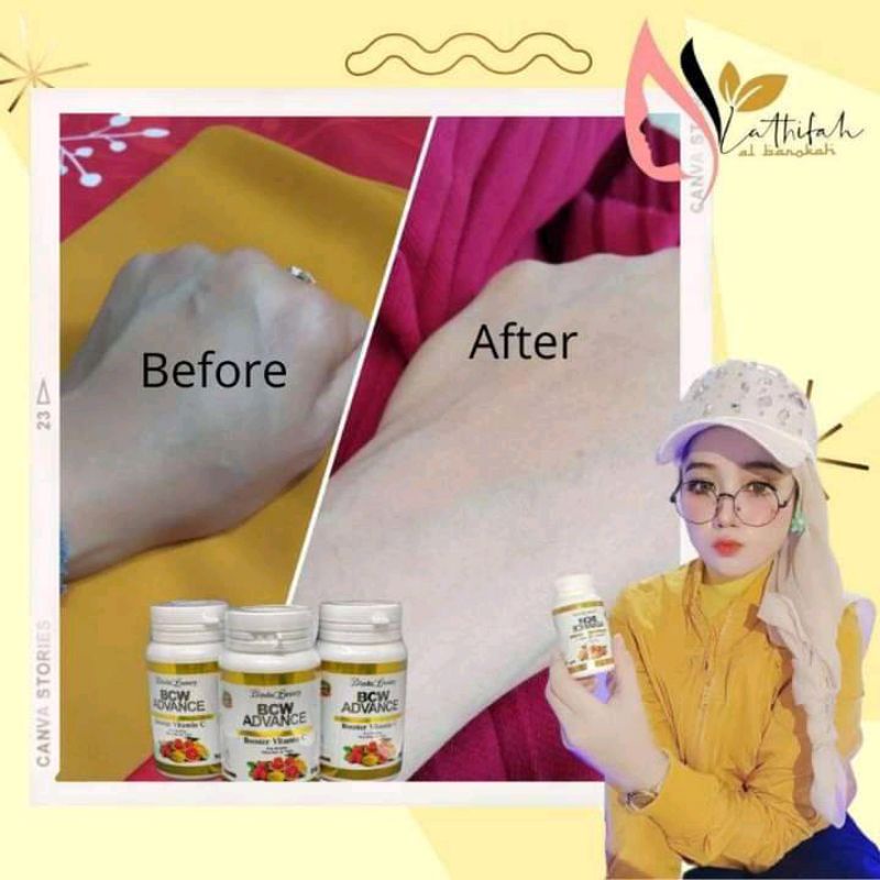 BCW ADVANCE ORI | PEMUTIH WAJAH DAN BADAN | BOOSTER VIT C | SUPLEMEN PERAWATAN KECANTIKAN