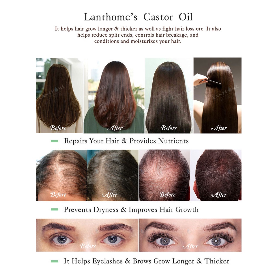 Lian Biquan Castor Oil Melembabkan akar rambut dengan lembut, memperbaiki rambut kusut, melembutkan alis, bulu mata, minyak rambut, meningkatkan pertumbuhan rambut