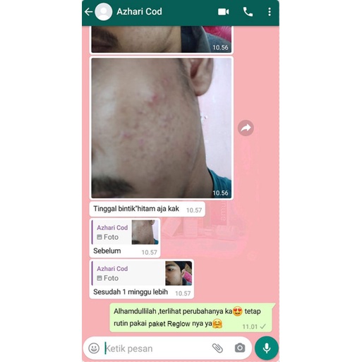Cream REGLOW Untuk menghilangkan Flek Jerawat Kerutan-5